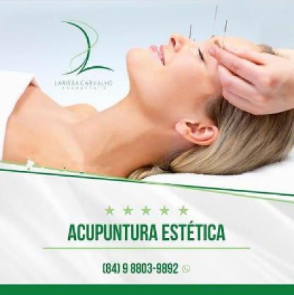 Acupuntura